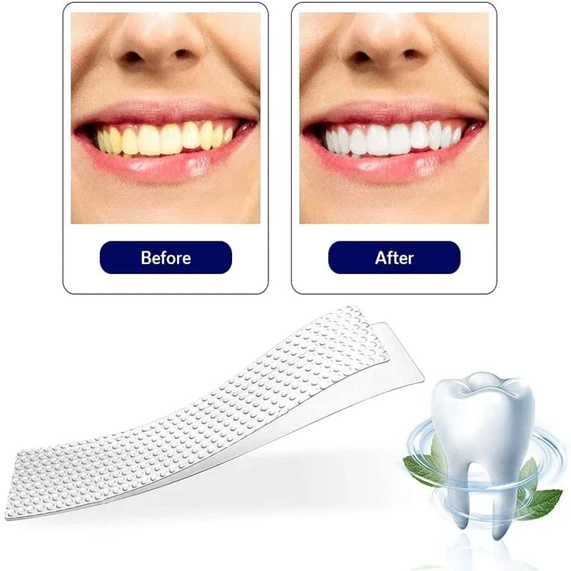 Teeth Whiteners